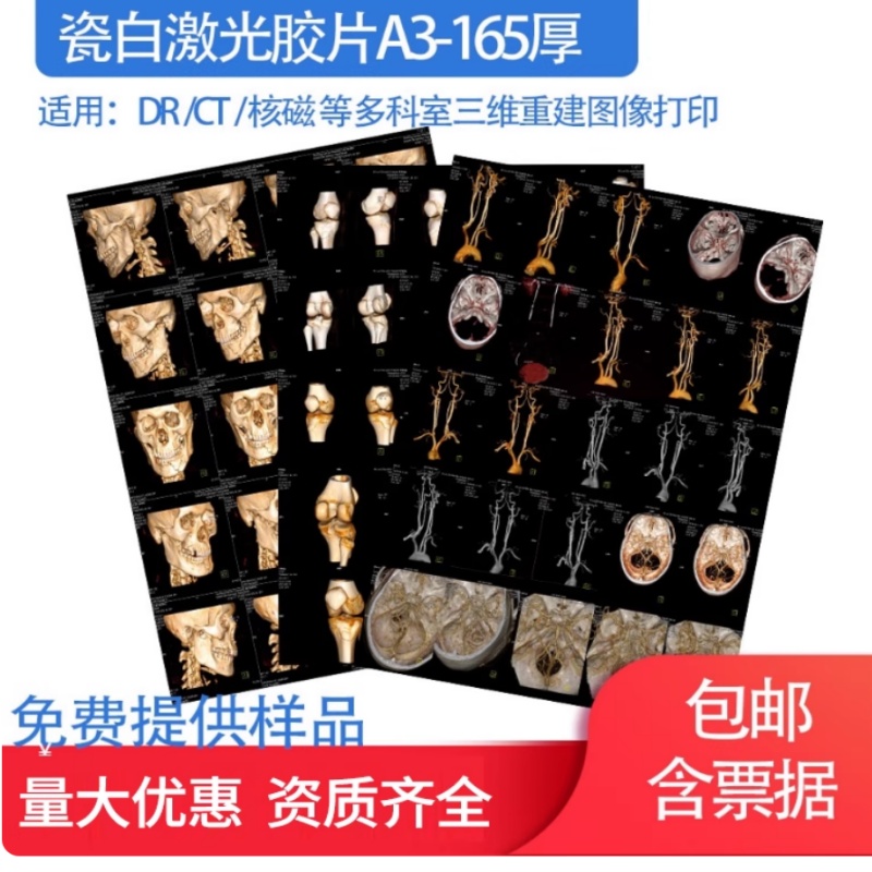 医用打印胶片/彩色胶片/三维重建胶片